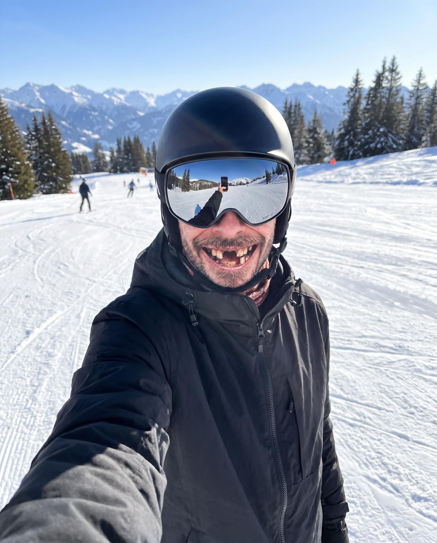 files/5A_no_tooth_gus_slope_selfie.png